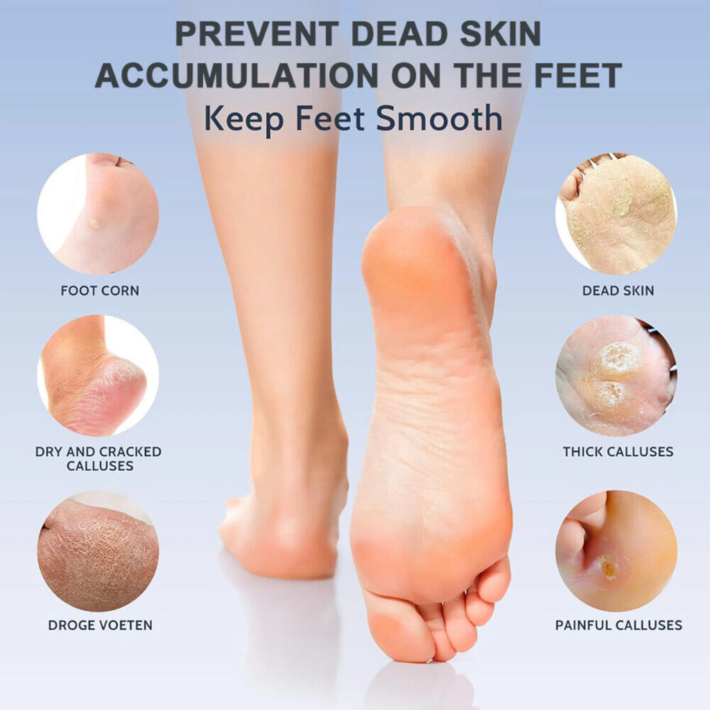 2 in 1 Electric File & Callus Remover