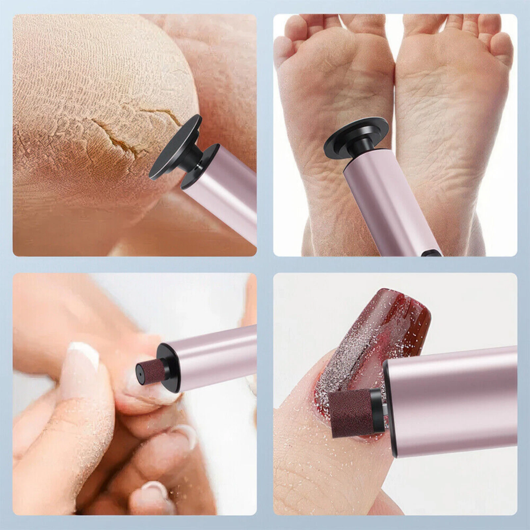 2 in 1 Electric File & Callus Remover